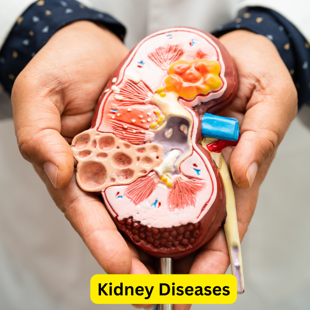 Kidney Diseases Doctor in Agra